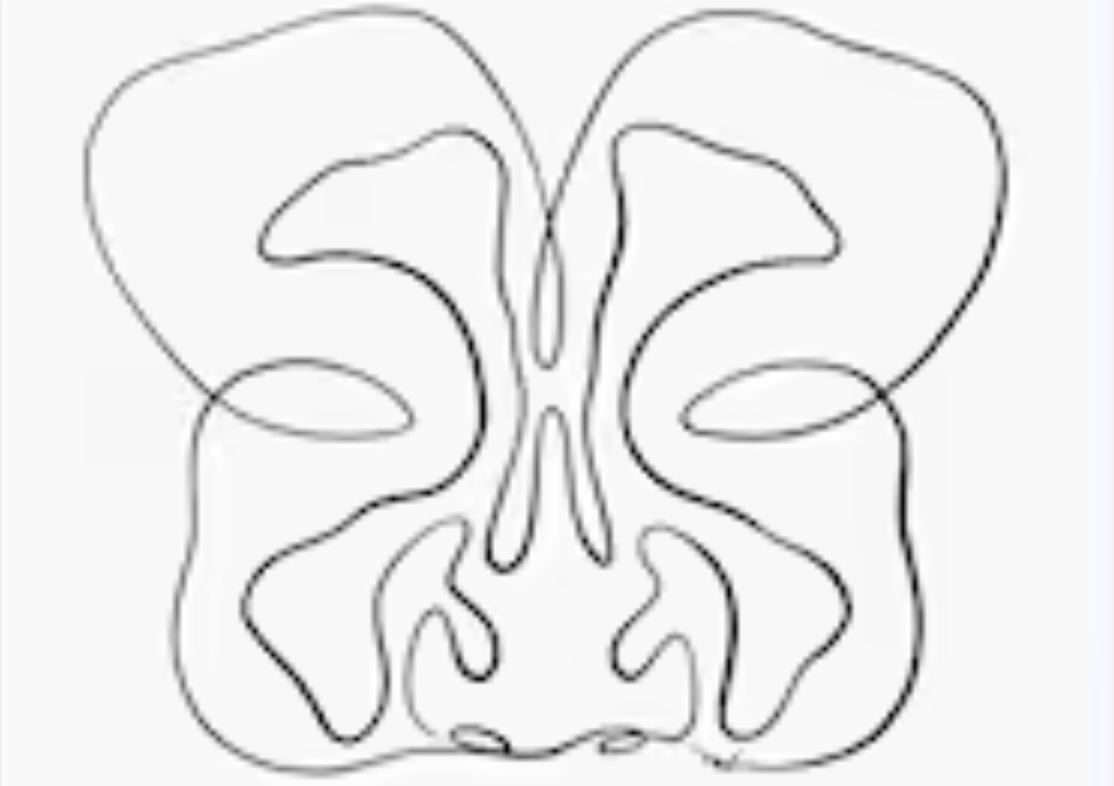 Advanced rhinology and sinus surgery